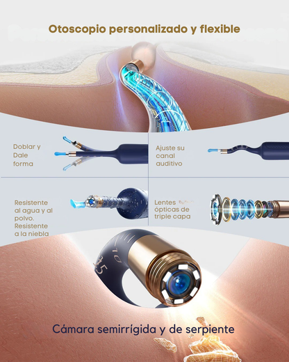 Limpiador de Oídos con Cámara HD