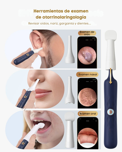 Limpiador de Oídos con Cámara HD